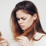 درمان ریزش موی تیپ مردانه در زنان