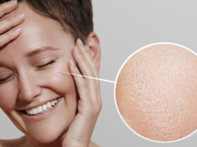 بهترین راهکارهای کاهش چربی پوست